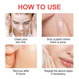 Hydrocolloid Invisible Acne Patch