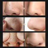 BREYLEE Blackhead Removal Mask and Essence Set